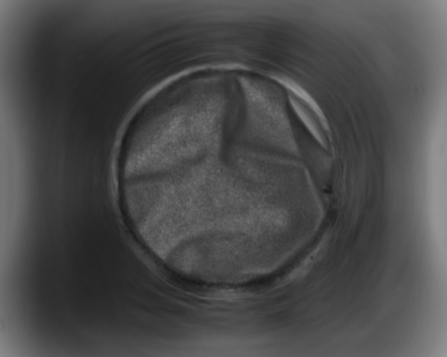 X0000087620935200705251959