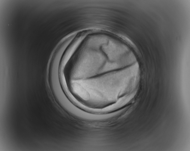 X0000087620940200705252000