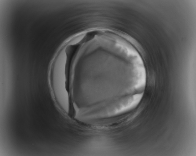 X0000087620958200705252000