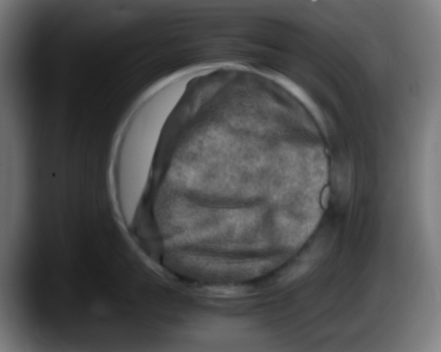 X0000087620959200705252000