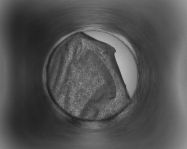 X0000087620999200705251959