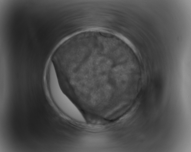 X0000087621007200705251959