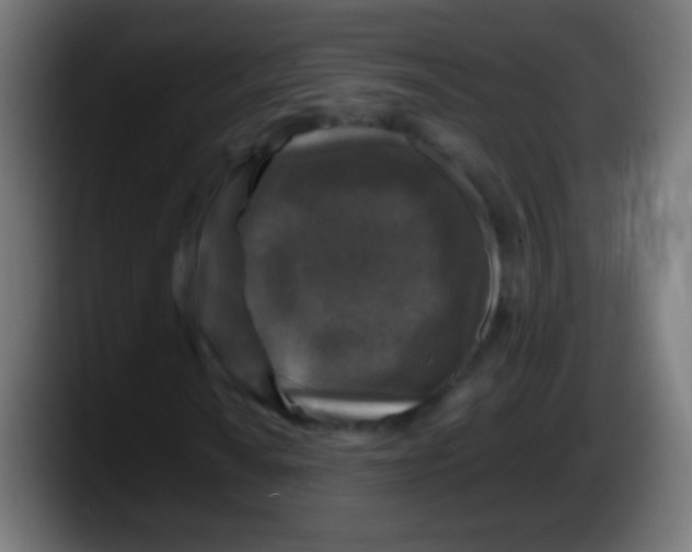 X0000087621010200705251958