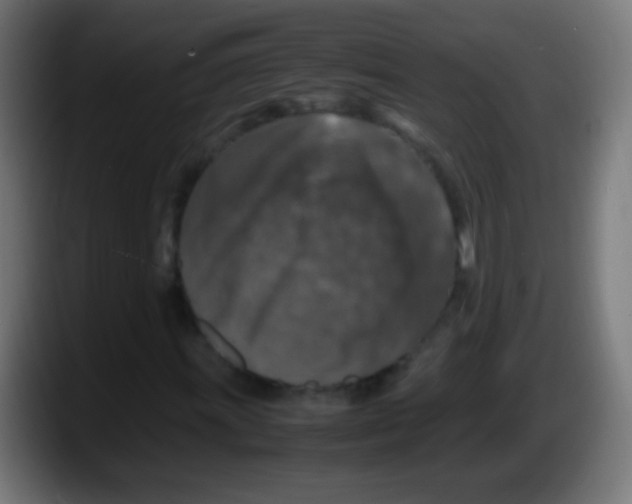 X0000087621011200705251958