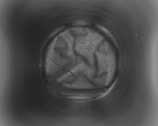 X0000087621017200705251958