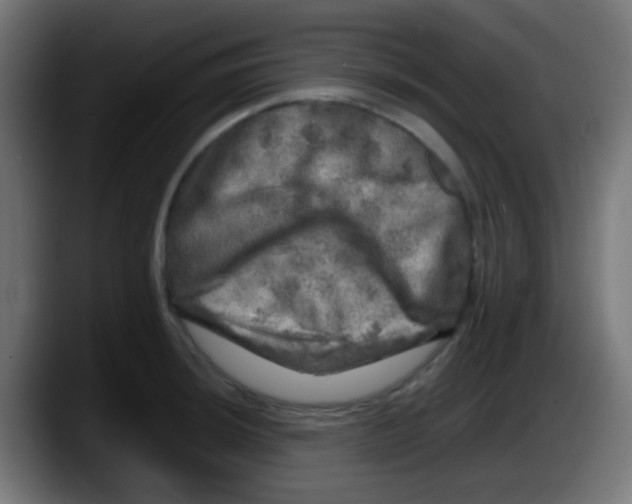 X0000087621044200705251958