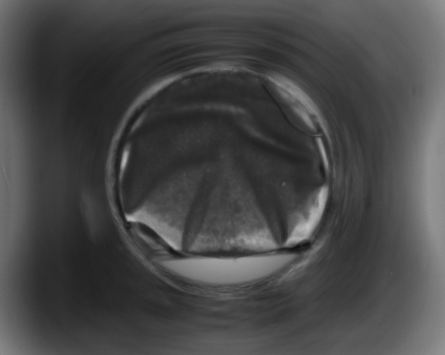 X0000087621045200705251958