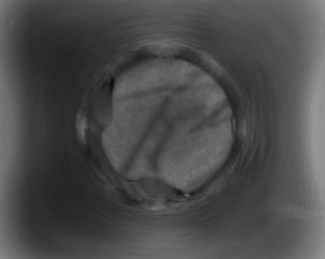 X0000087621108200705251957