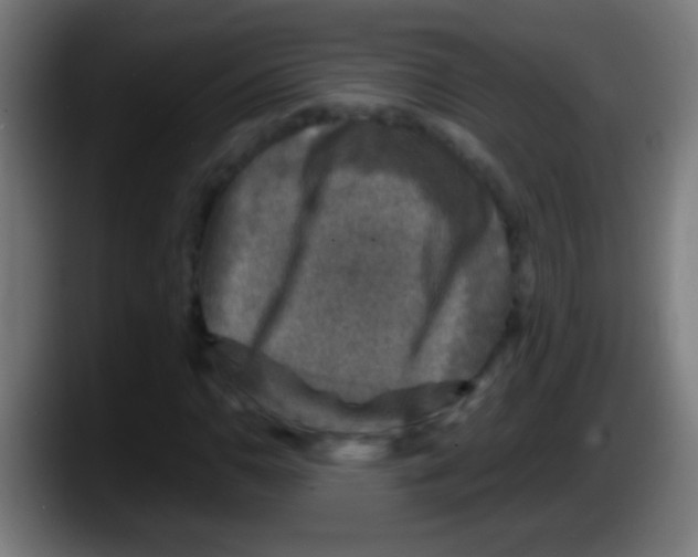X0000087621110200705251957