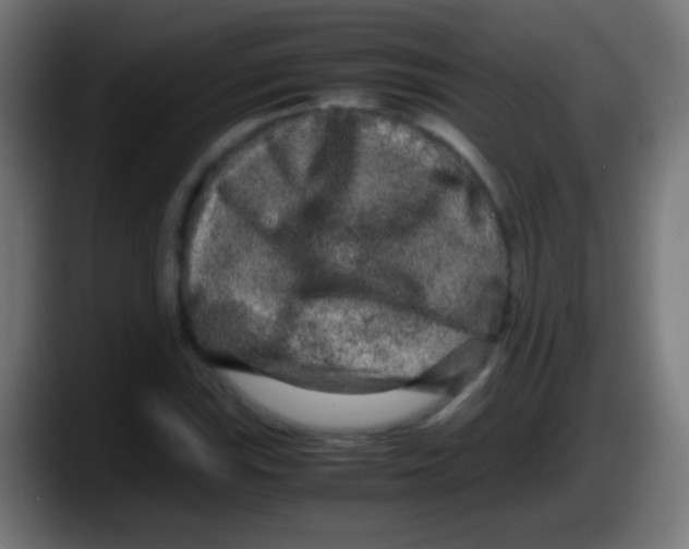 X0000087621115200705251957