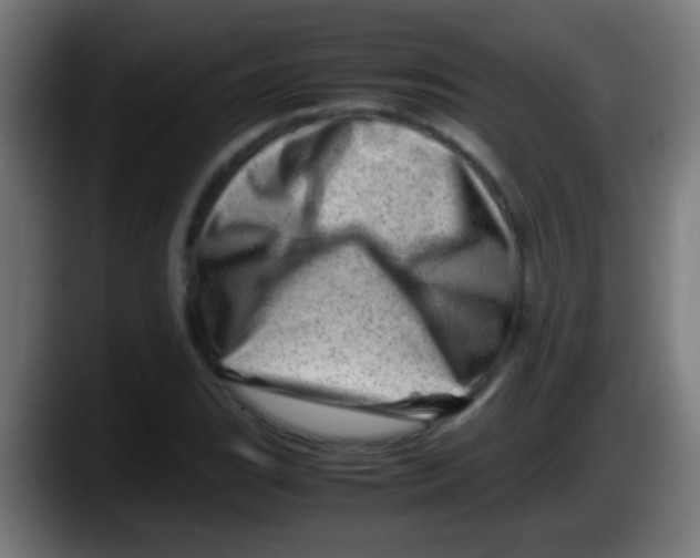 X0000087621119200705251957