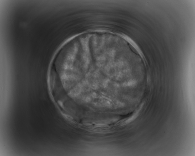 X0000087621149200705251957