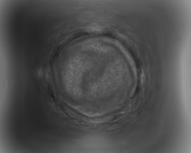 X0000087621157200705251957