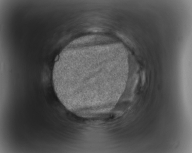 X0000087621158200705251957