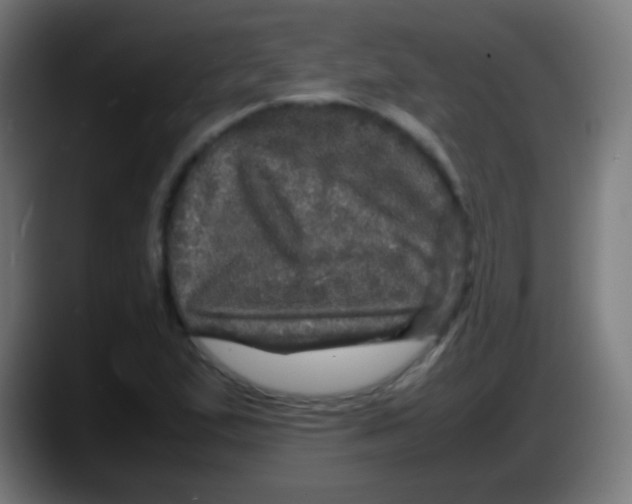 X0000087621167200705251957