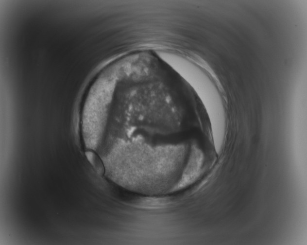 X0000087621179200705251956