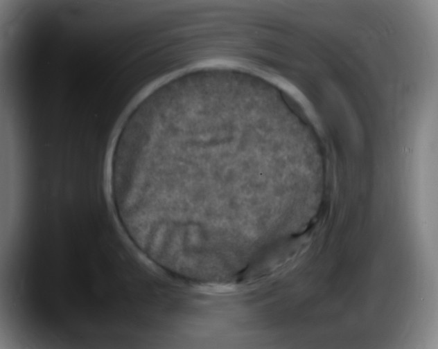 X0000087621199200705251956