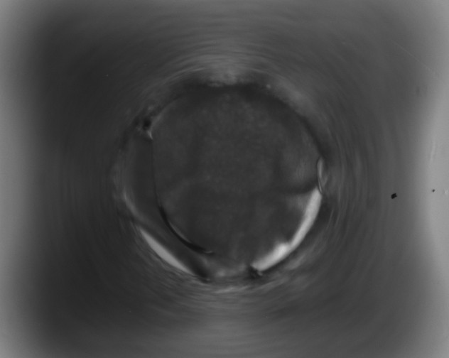 X0000087621202200705251955