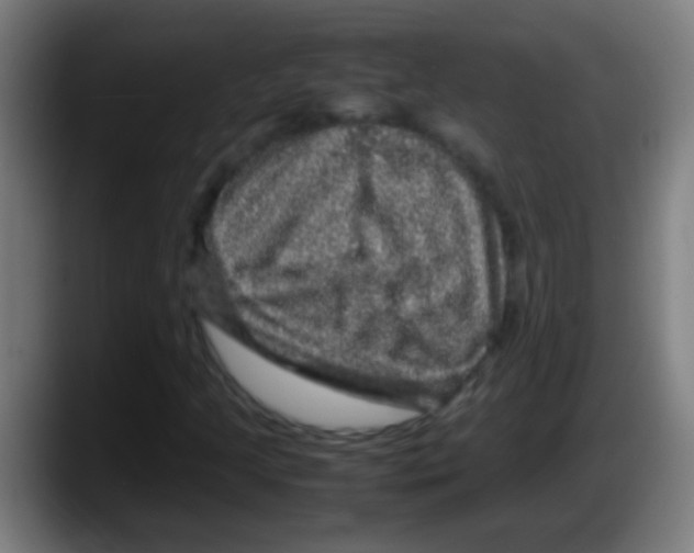 X0000087621205200705251956