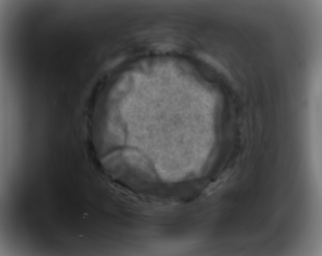 X0000087621207200705251956