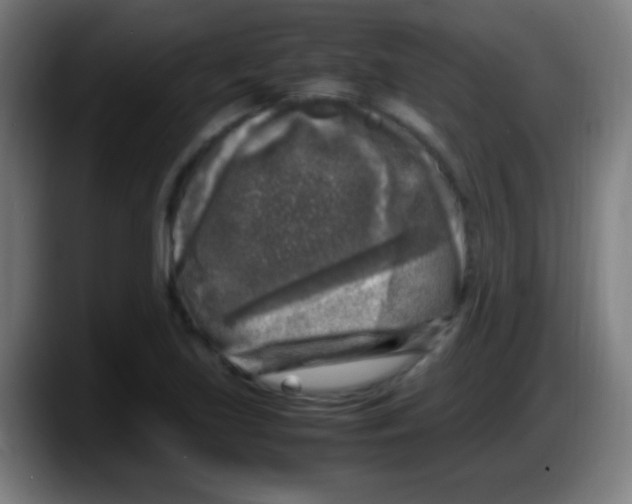 X0000087621219200705251956