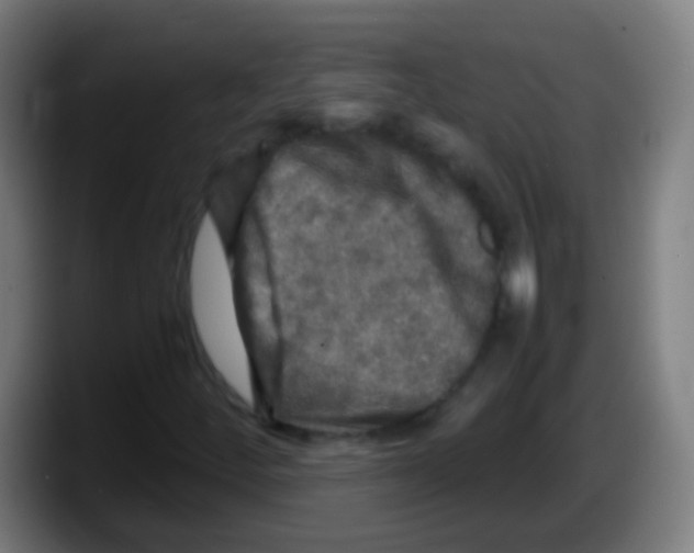 X0000087621252200705251955