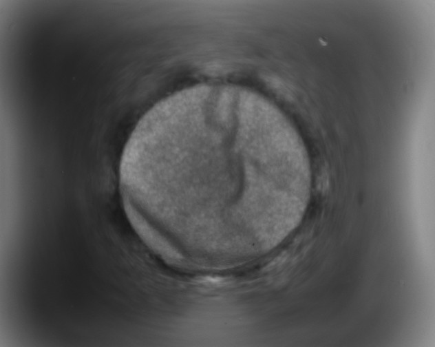 X0000087621253200705251955