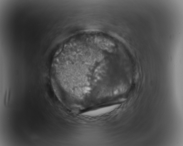 X0000087621255200705251955