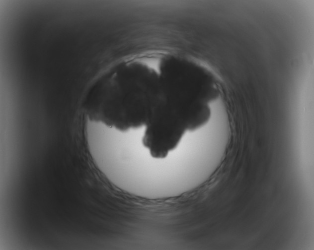 X0000087621256200705251955