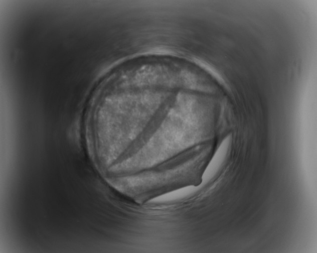 X0000087621264200705251955