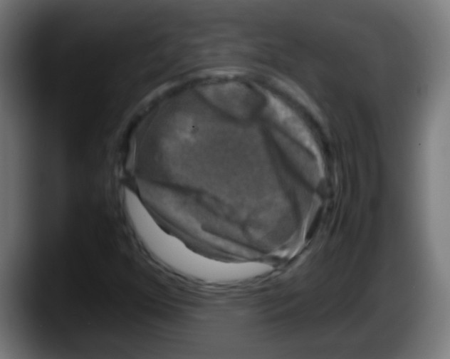 X0000087621352200705251954