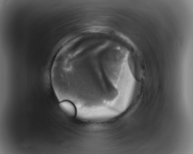 X0000087621362200705251954