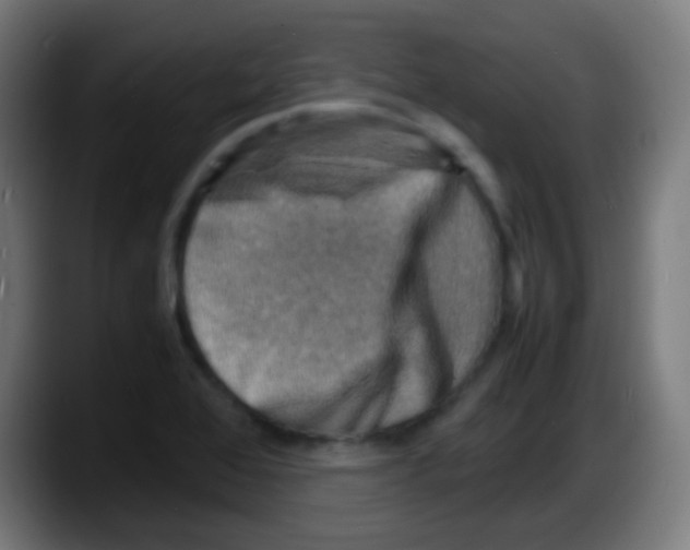 X0000087621368200705251954