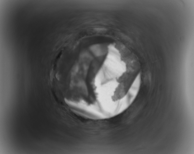 X0000087621397200705251953