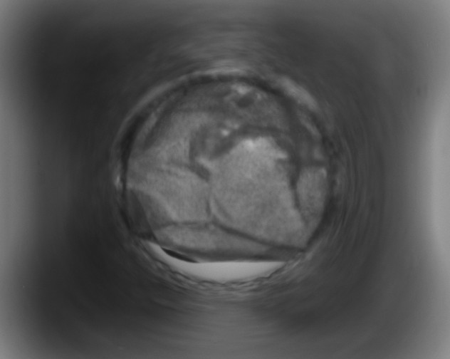 X0000087621400200705251953