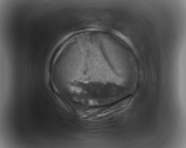 X0000087621415200705251953