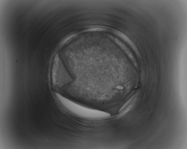 X0000087621417200705251953