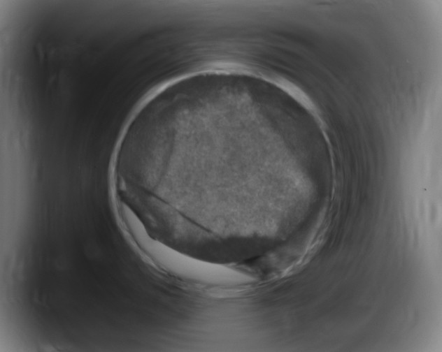 X0000087621440200705251954