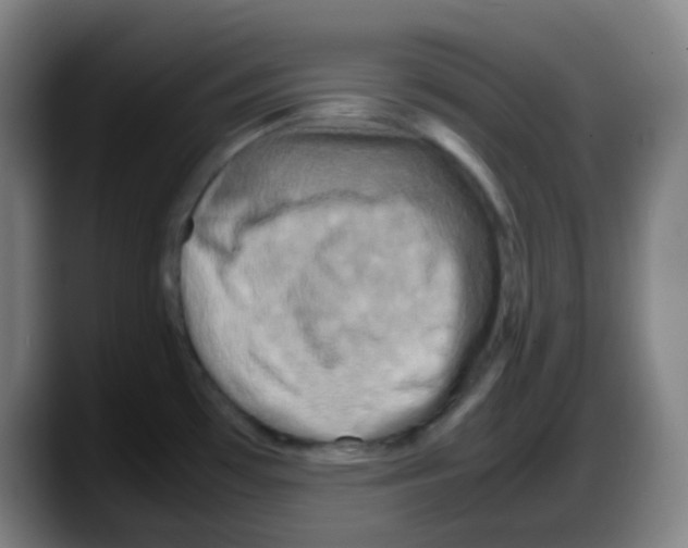 X0000087621481200705251952