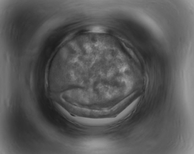 X0000087621487200705251952