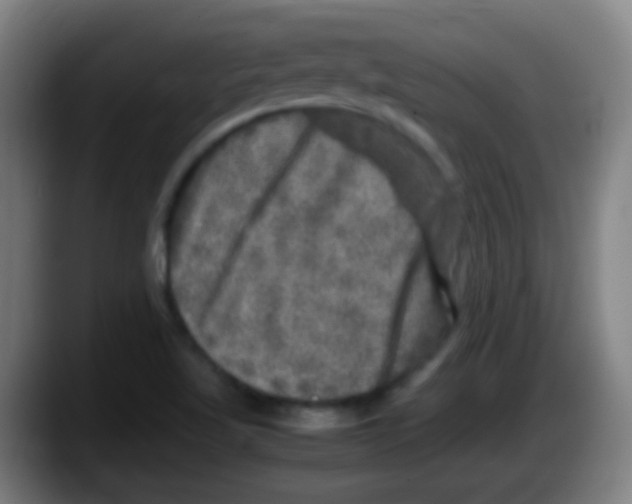 X0000087621509200705251952