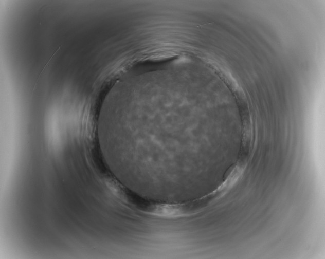 X0000087630078200705101036