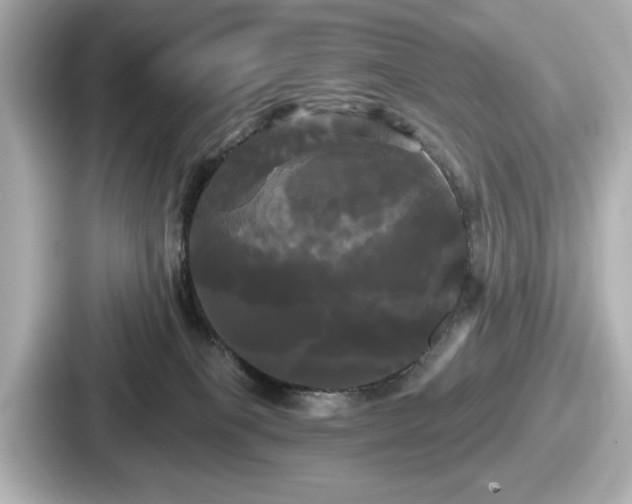 X0000087630085200705101036