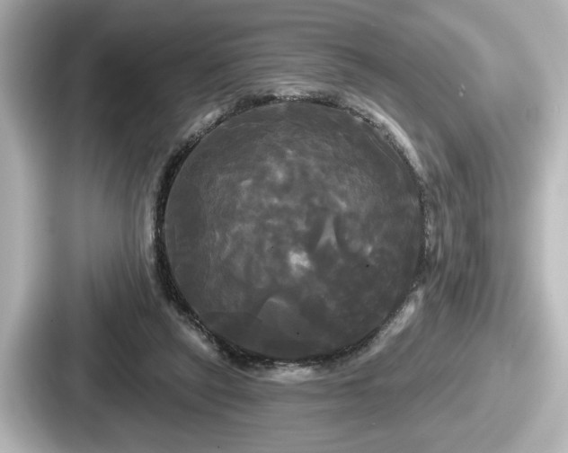 X0000087630257200705101033