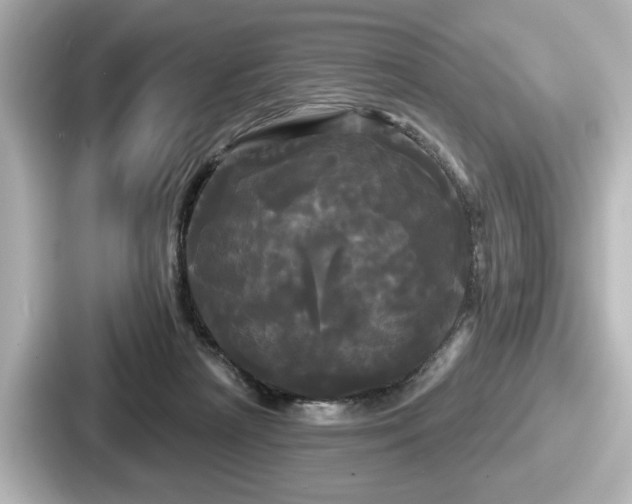 X0000087630265200705101033