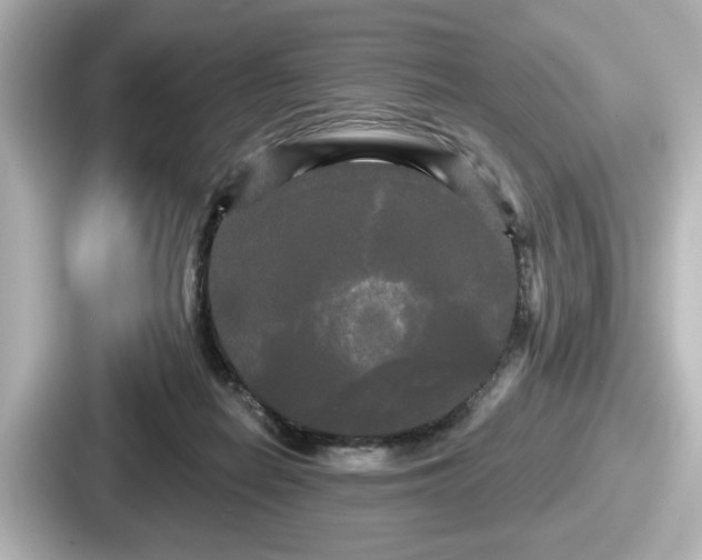 X0000087630266200705101033