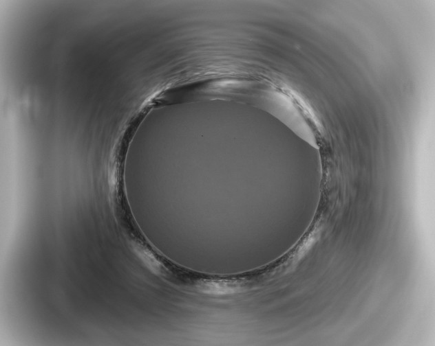 X0000087630305200705101033