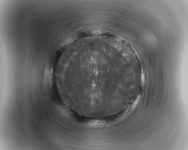 X0000087630319200705101033