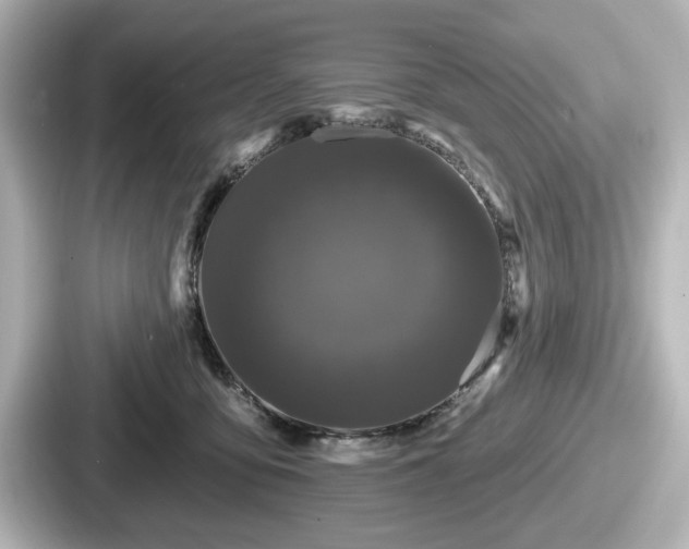 X0000087630419200705101031