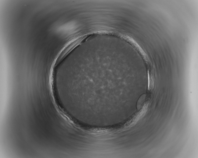 X0000087630435200705101031